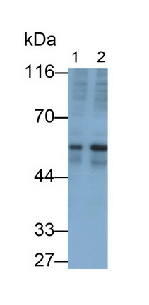 Transforming Growth Factor Beta 2 (TGFb2) Human Monoclonal Antibody