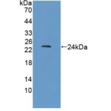 Interferon Beta (IFNb) Bovine (Cattle) Monoclonal Antibody
