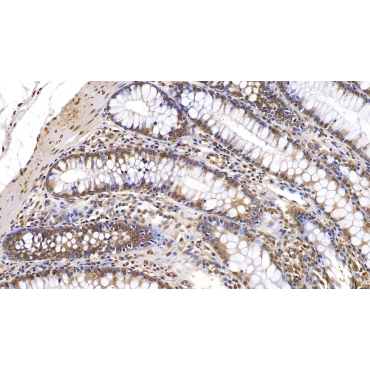 Interferon Beta (IFNb) Human Monoclonal Antibody