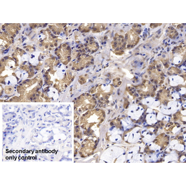 Interferon Beta (IFNb) Human Monoclonal Antibody