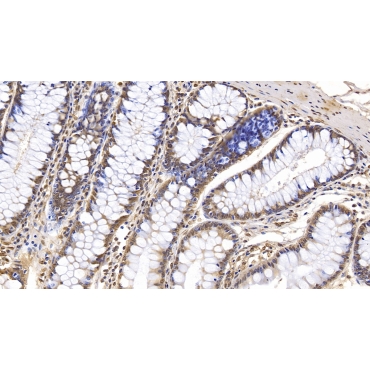 Interferon Beta (IFNb) Human Monoclonal Antibody