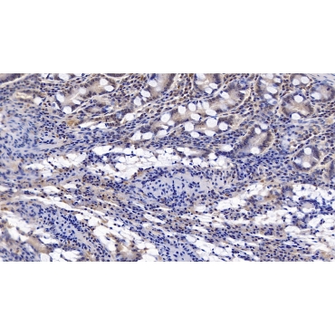 Interferon Beta (IFNb) Human Monoclonal Antibody