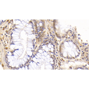 Interferon Beta (IFNb) Human Monoclonal Antibody
