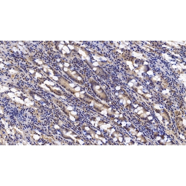 Interferon Beta (IFNb) Human Monoclonal Antibody