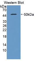 Interferon Beta (IFNb) Pig Monoclonal Antibody