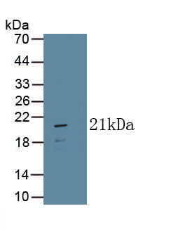 Interferon Beta (IFNb) Rat Monoclonal Antibody