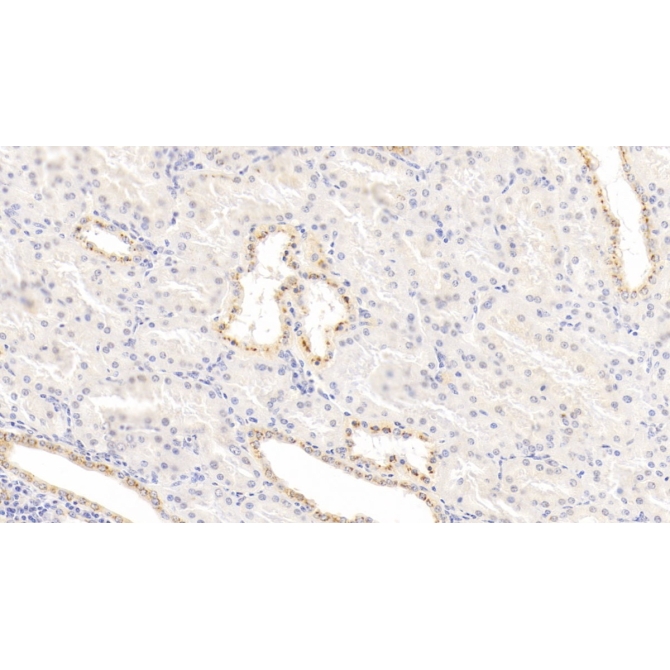 Interleukin 1 Receptor Antagonist (IL1RA) Human Monoclonal Antibody