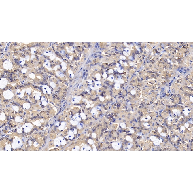 Interleukin 1 Receptor Antagonist (IL1RA) Human Monoclonal Antibody