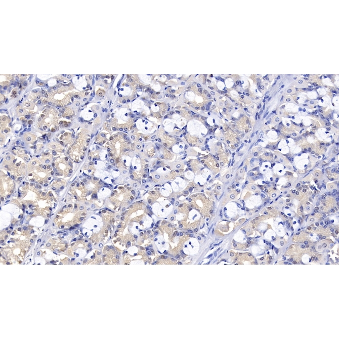 Interleukin 1 Receptor Antagonist (IL1RA) Human Monoclonal Antibody