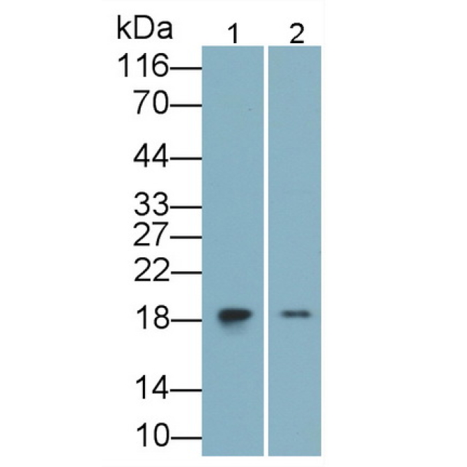 Interleukin 1 Receptor Antagonist (IL1RA) Human Monoclonal Antibody