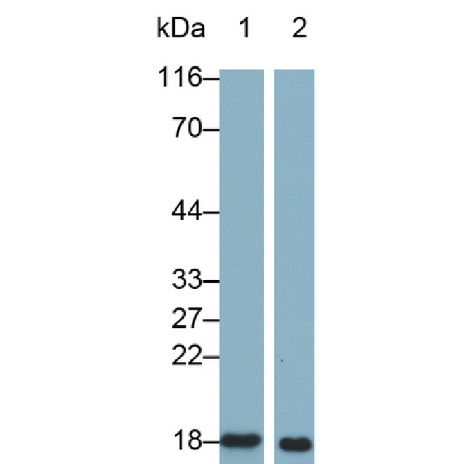 Interleukin 1 Receptor Antagonist (IL1RA) Human Monoclonal Antibody