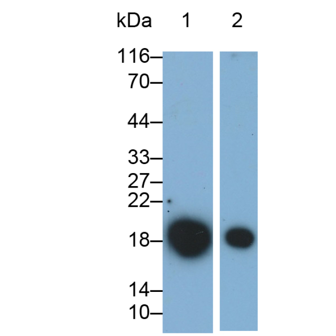 Interleukin 1 Receptor Antagonist (IL1RA) Human Monoclonal Antibody