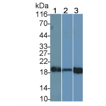 Cyclophilin B (CYPB) Human Monoclonal Antibody