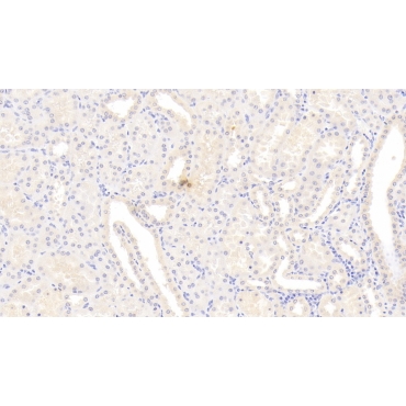 Cyclophilin B (CYPB) Human Monoclonal Antibody