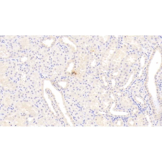 Cyclophilin B (CYPB) Human Monoclonal Antibody