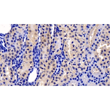 Cyclophilin B (CYPB) Human Monoclonal Antibody