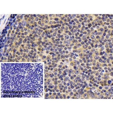 Cyclophilin B (CYPB) Human Monoclonal Antibody