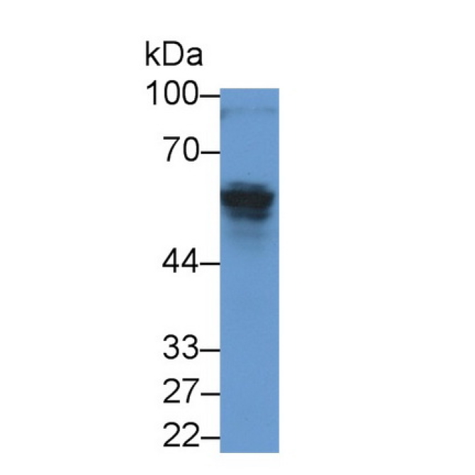 Anti-Mullerian Hormone (AMH) Human Monoclonal Antibody