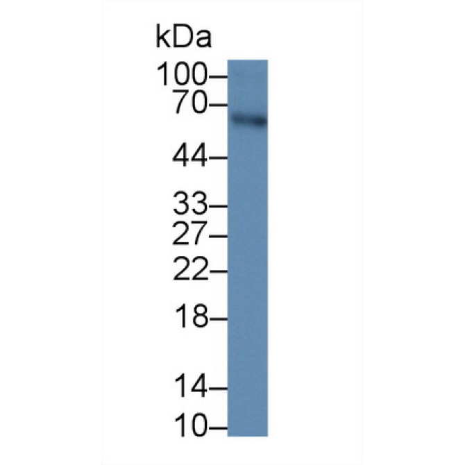 Anti-Mullerian Hormone (AMH) Human Monoclonal Antibody