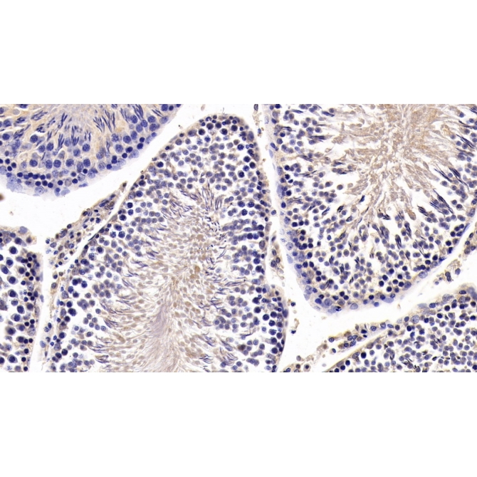 Anti-Mullerian Hormone (AMH) Human Monoclonal Antibody