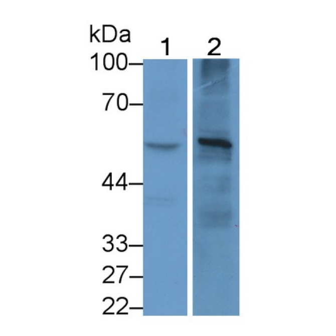 Anti-Mullerian Hormone (AMH) Human Monoclonal Antibody