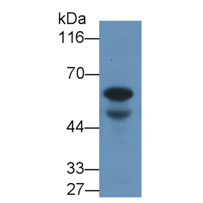 Anti-Mullerian Hormone (AMH) Human Monoclonal Antibody