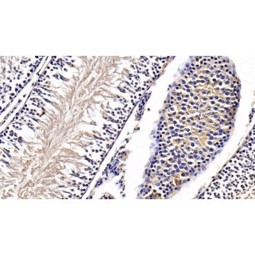 Anti-Mullerian Hormone (AMH) Human Monoclonal Antibody