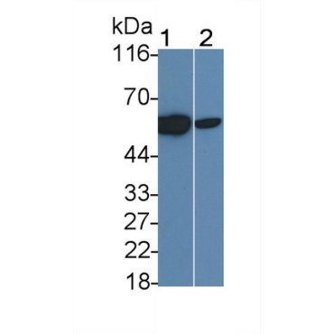 Interleukin 2 Receptor Beta (IL2Rb) Human Monoclonal Antibody