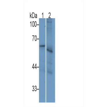 Interleukin 2 Receptor Beta (IL2Rb) Human Monoclonal Antibody