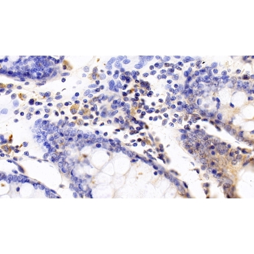 Interleukin 2 Receptor Beta (IL2Rb) Human Monoclonal Antibody