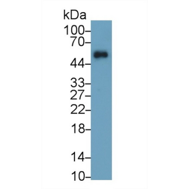 Immunoglobulin G4 (IgG4) Human Monoclonal Antibody