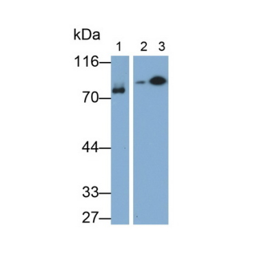 Complement 1 Inhibitor (C1INH) Human Monoclonal Antibody