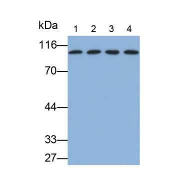Complement 1 Inhibitor (C1INH) Human Monoclonal Antibody