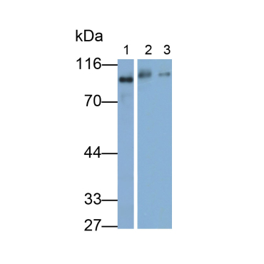 Complement 1 Inhibitor (C1INH) Human Monoclonal Antibody