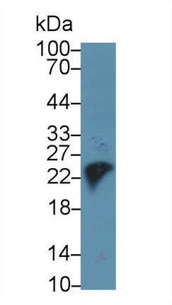 Trypsin (TRY) Pig Monoclonal Antibody