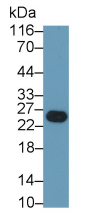 Trypsin (TRY) Pig Monoclonal Antibody