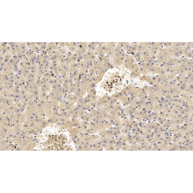 Apolipoprotein C1 (APOC1) Human Monoclonal Antibody
