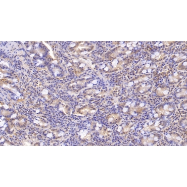 Annexin V (ANXA5) Human Monoclonal Antibody