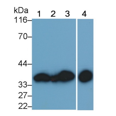 Annexin V (ANXA5) Human Monoclonal Antibody