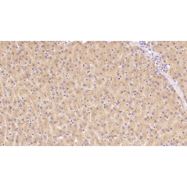 Beta-2-Microglobulin (b2M) Human Monoclonal Antibody