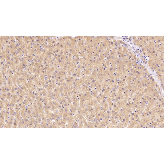Beta-2-Microglobulin (b2M) Human Monoclonal Antibody