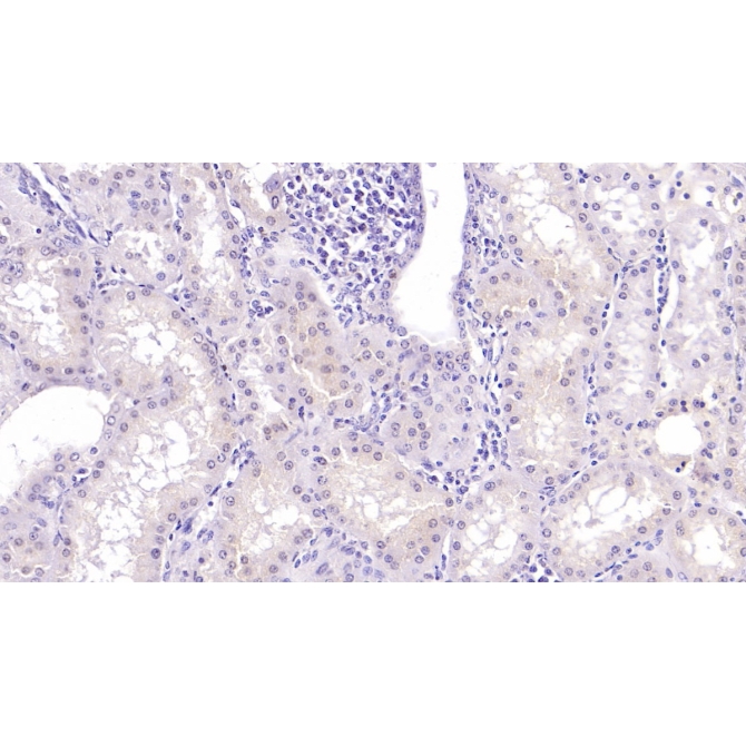 Beta-2-Microglobulin (b2M) Human Monoclonal Antibody