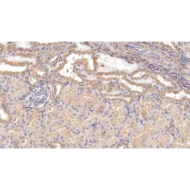 Beta-2-Microglobulin (b2M) Human Monoclonal Antibody