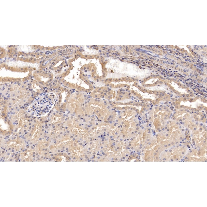 Beta-2-Microglobulin (b2M) Human Monoclonal Antibody
