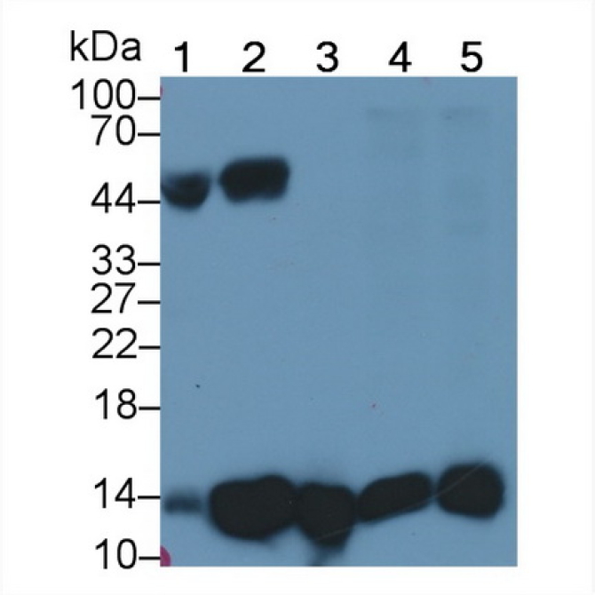 Beta-2-Microglobulin (b2M) Human Monoclonal Antibody