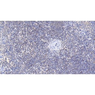 Beta-2-Microglobulin (b2M) Human Monoclonal Antibody