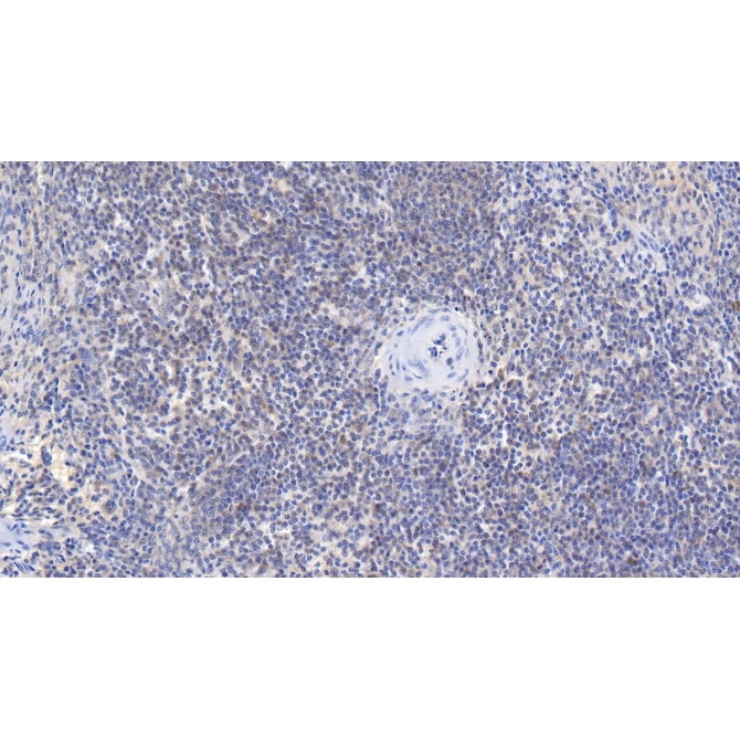 Beta-2-Microglobulin (b2M) Human Monoclonal Antibody