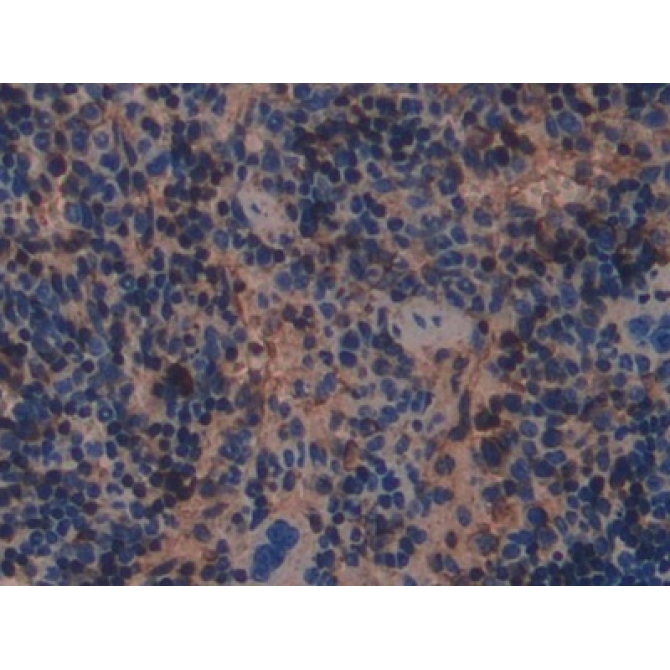 Beta-2-Microglobulin (b2M) Mouse Monoclonal Antibody