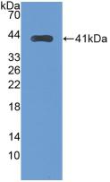Transferrin Receptor 2 (TFR2) Human Monoclonal Antibody