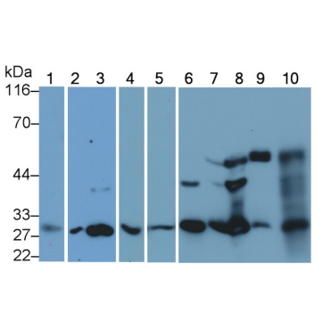 Cathepsin K (CTSK) Human Monoclonal Antibody